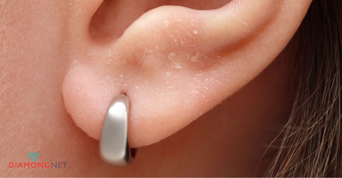 Comparison of hypoallergenic properties between rose gold and yellow gold